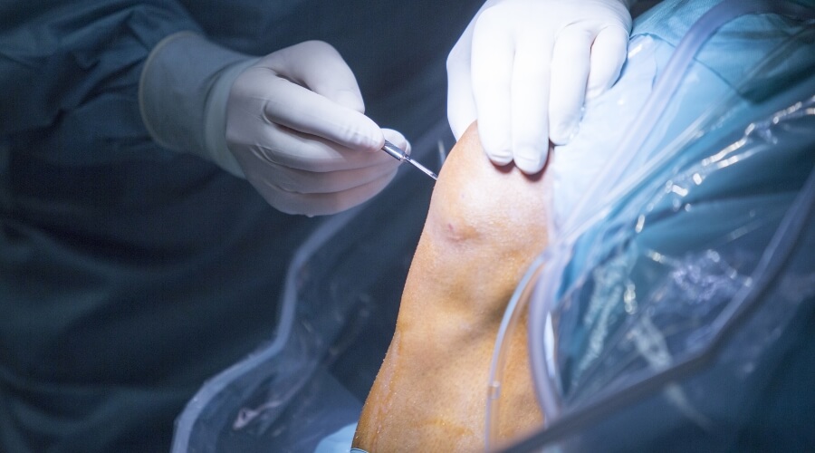 Lesões Ligamentares no Joelho Cirurgia - Joelho Recife - Dr. Diego Pires